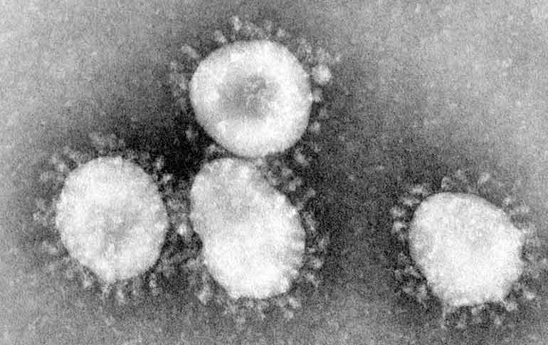 ویروس کرونا COVID-19 و راه های پیشگیری و تشخیص علائم کرونا